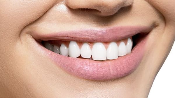 About tooth whitening