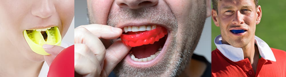Keeping your mouth safe while playing sport