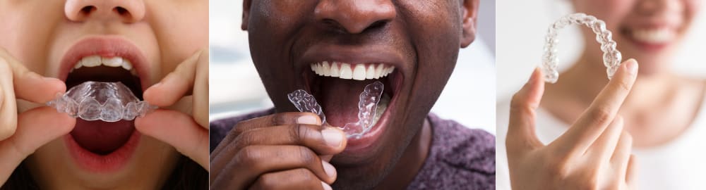 DIY Consumer Dentistry Podcast Part 2